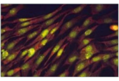 fibroblastos-estimulados